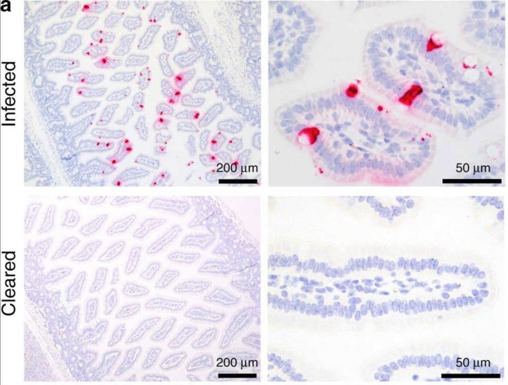 Magnified image of mice intestine cell infected by astrovirus